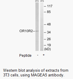 Product image for MAGEA5 Antibody