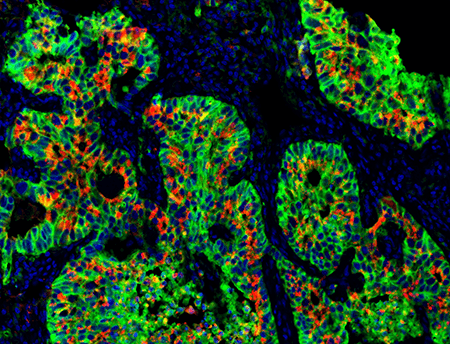 PSA mulitcolor tissue stain