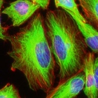 Image of HeLa cells