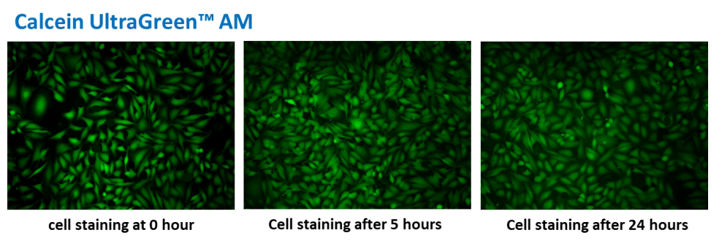 Fluorescence images of HeLa cells