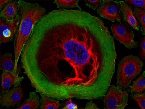 Immunostain