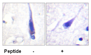 paraffin-embedded human brain tissue