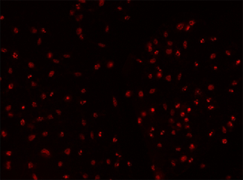 SS 1 µM