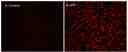 Response of endogenous P2Y receptor to ATP in CHO-K cells detected with Cal-630 &trade; AM.&nbsp; CHO-K1 cells were seeded overnight at 50,000 cells per 100 &micro;L per well in a Costar black wall/clear bottom 96-well plate. 100 uL of 5 uM Cal-630 &trade; AM in HHBS (with 1.0 mM probenecid) was added into the cells and incubated at 37 &deg;C for 1 hour.&nbsp; Images were recorded with a fluorescence microscope (Olympus IX71) before and after adding 10 uM ATP (final in the well) using Texas Red Channel.