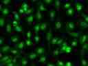 <strong>CYTO-13 </strong><strong>live-cell nucleic acid stain</strong><strong>.</strong><br>Live HeLa cells were stained with 2.5uM CYTO-13 (Cat# 17553) for 20 minutes at 37&deg;C, washed once with HH buffer, and then imaged with FITC filter.