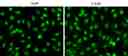 Images of HeLa cells stained with CYO-13 at 5 uM (Left) and 2.5 uM (Right) for 20 minutes at 37&deg;C incubator. Images were acquired using fluorescence microscope with FITC filter