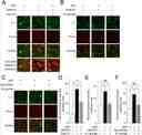 GPR157 couples with Gq-class of the heterotrimeric G-proteins. (A&ndash;C) Plasmids expressing indicated protein were transfected into U-2 OS cells. Rhod-4, a fluorescent calcium indicator, were used to assess changes in [Ca<sup>2+</sup>]i. Application of Ionomycin, a calcium ionopohore, to cells after experiments confirmed almost uniform uptake of Rhod-4 in these cells. (D&ndash;F) Fluorescent intensity of Rhod4 in GFP-positive cells. Mean&thinsp;&plusmn;&thinsp;s.e.m. Data were obtained from 3 independent experiments (more than 40 cells). **p&thinsp;&lt;&thinsp;0.01, ***p&thinsp;&lt;&thinsp;0.001. Scale bar: 10&thinsp;&mu;m. Source: <strong>The G protein-coupled receptor GPR157 regulates neuronal differentiation of radial glial progenitors through the Gq-IP3 pathway </strong>by Takeo et al., <em>Scientific Reports</em>, May 2016.
