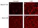 ATP-stimulated calcium responses of endogenous P2Y receptors were measured in CHO-K1 cells with Rhod-4&trade; AM (Cat# 21120) and Rhod-2 AM (Cat# 21064). CHO-K1 cells were seeded overnight at 50,000 cells/100 &micro;L/well in a Costar 96-well black wall/clear bottom plate. The growth medium was removed, and the cells were incubated with 100 &micro;L of dye loading solution using Rhod-4&trade; AM (4 &micro;M, A and B) or Rhod-2 AM (4 &micro;M, C and D) for 1 hour in a 37 &deg;C, 5% CO2 incubator. The staining solution was replaced with 200 &micro;L HHBS, then the cells were imaged before (A and C) and after (B and D) ATP treatment with a fluorescence microscope (Olympus IX71) using TRITC channel.