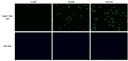 Response of Gramicidin A (10 µM) with varying sodium ion concentrations in HeLa cells. HeLa cells were seeded overnight at 40,000 cells/100 µL/well in a 96-well Costar plate. 100 µL of SoNa™ 520 AM or SBFI-AM in HHBS with 0.02% PF-127 was added, and cells were incubated at 37 °C for 1 hour. Dye-loading mediums were replaced with 100 µL HHBS containing Gramicidin A (0, 40, and 140 mM sodium ions). After 30 minutes, images were captured using a fluorescence microscope (Olympus IX71) with the FITC channel.