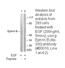 Product image for EFNB1/2 (Ab-330) Antibody