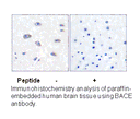 Product image for BACE (Ab-498) Antibody