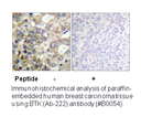 Product image for BTK (Ab-222) Antibody