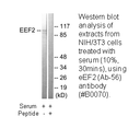 Product image for eEF2 (Ab-56) Antibody