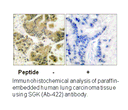 Product image for SGK (Ab-422) Antibody