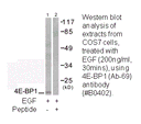 Product image for 4E-BP1 (Ab-69) Antibody