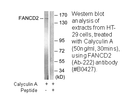 Product image for FANCD2 (Ab-222) Antibody