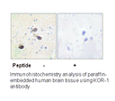 Product image for KOR-1 (Ab-369) Antibody