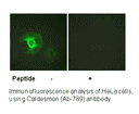 Product image for Caldesmon (Ab-789) Antibody