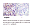 Product image for IKK-&beta; (Ab-199) Antibody