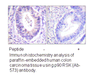 Product image for p90 RSK (Ab-573) Antibody