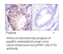 Product image for PAK1 (Ab-212) Antibody