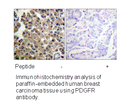 Product image for PDGFRB (Ab-1009) Antibody