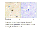 Product image for RyR2 (Ab-2808) Antibody