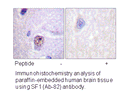 Product image for SF1 (Ab-82) Antibody
