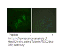 Product image for Tuberin/TSC2 (Ab-939) Antibody