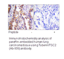 Product image for Tuberin/TSC2 (Ab-939) Antibody