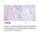 Product image for ZAP-70 (Ab-315) Antibody