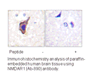 Product image for NMDAR1 (Ab-890) Antibody