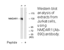 Product image for NMDAR1 (Ab-890) Antibody