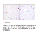 Product image for PLD1 (Ab-561) Antibody