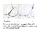 Product image for AhR (Ab-36) Antibody