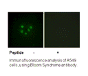 Product image for Bloom Syndrome (Ab-99) Antibody