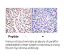 Product image for Bloom Syndrome (Ab-99) Antibody