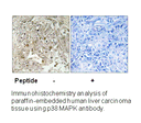 Product image for p38 MAPK (Ab-179/181) Antibody