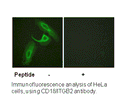 Product image for CD18/ITGB2 (Ab-758) Antibody