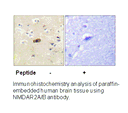 Product image for NMDAR2A/B (Ab-1246/1252) Antibody