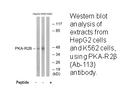 Product image for PKA-R2&beta; (Ab-113) Antibody