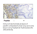 Product image for Tryptophan Hydroxylase (Ab-260) Antibody