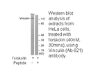 Product image for Vinculin (Ab-821) Antibody