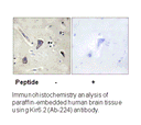 Product image for Kir6.2 (Ab-224) Antibody