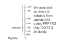 Product image for PPP1R2 (Ab-120/121) Antibody