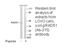 Product image for RAD51 (Ab-315) Antibody
