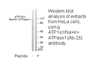 Product image for ATP1&alpha;1/Na+K+ ATPase1 (Ab-23) Antibody