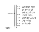 Product image for FOXO4 (Ab-451) Antibody