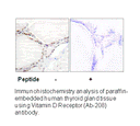 Product image for Vitamin D Receptor (Ab-208) Antibody