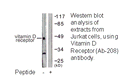 Product image for Vitamin D Receptor (Ab-208) Antibody